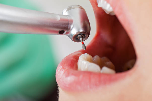 Best Urgent Tooth Repair  in Liberty, SC